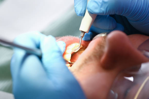 Best Dental Abscess Treatment in Dunn, NC