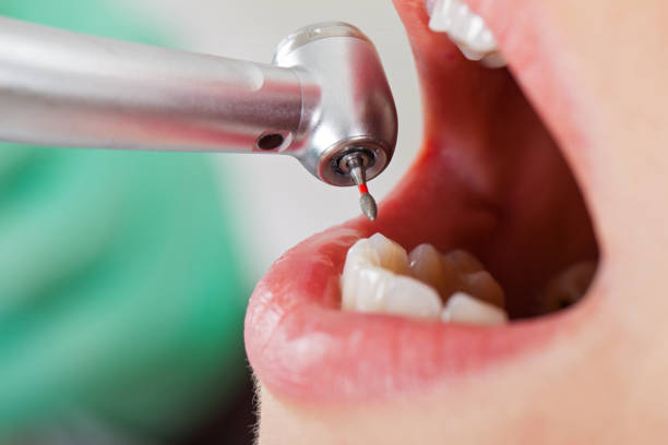 Best Emergency Care for Gum Disease in Dunn, NC
